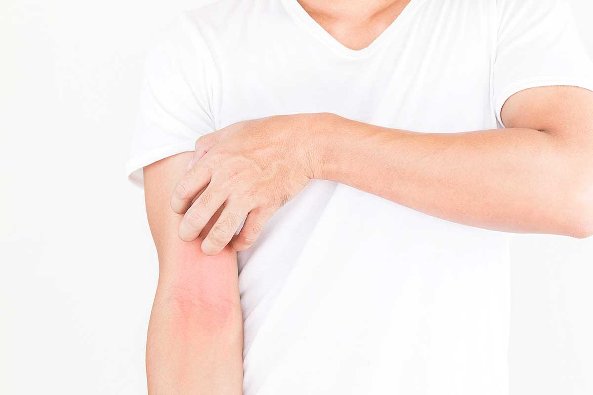 Tout-ce-que-vous-devez-savoir-sur-la-dyshidrose